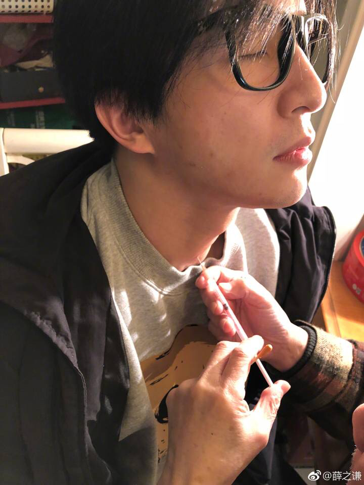 薛之谦声带发炎，雾化已无效，需针头注射治疗