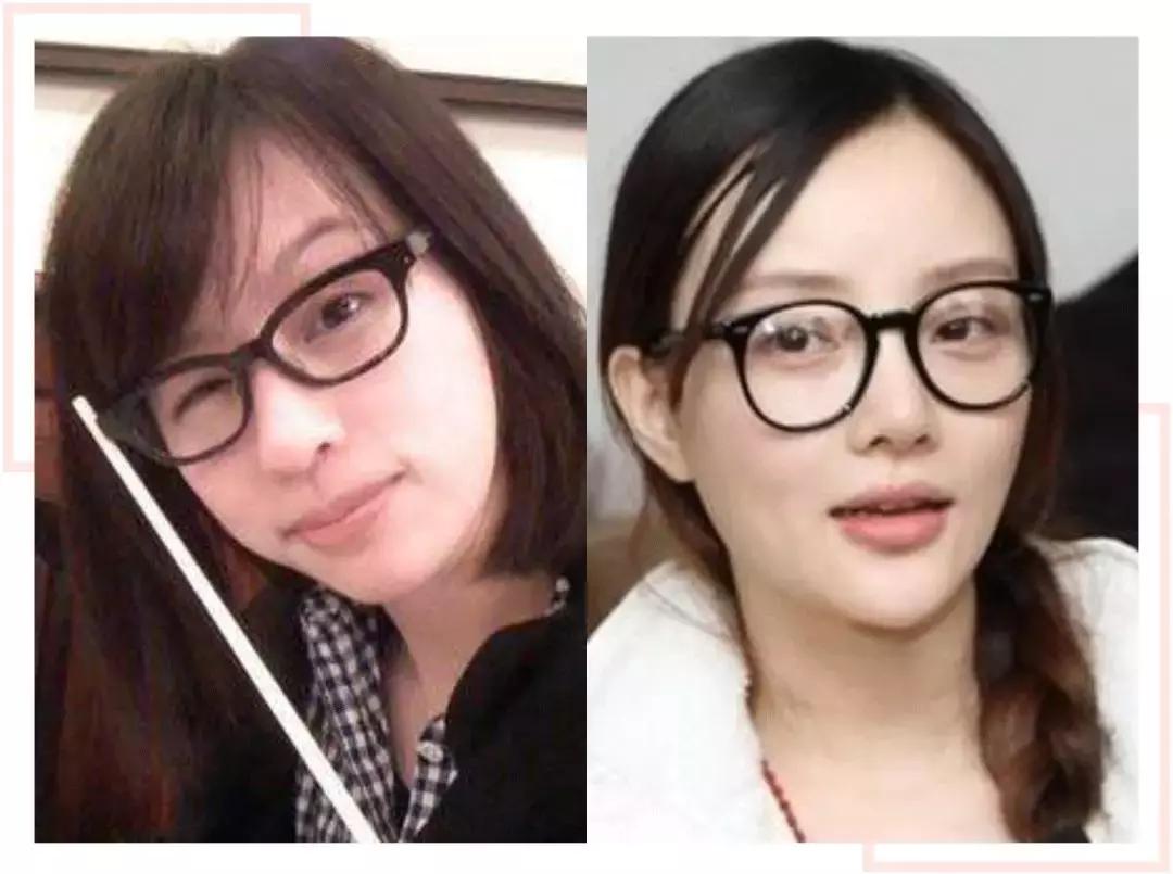 选对眼镜能提高颜值吗,选对眼镜堪比整容