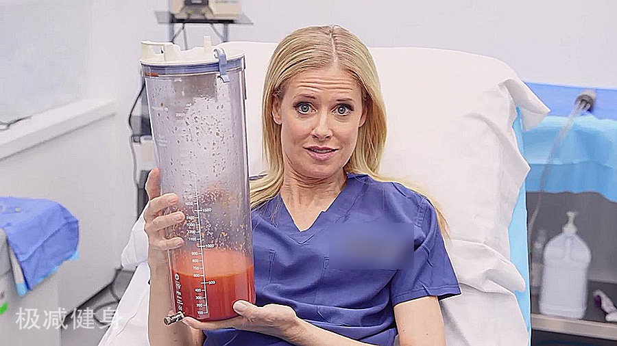 抽脂减肥的过程与效果,抽脂减肥的过程和效果