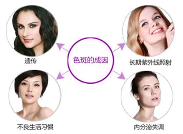 褐斑有几种,褐青色斑什么原因