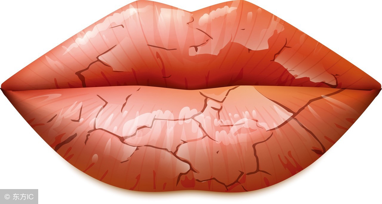 嘴唇干燥缺水怎么解决,嘴唇干燥起皮怎么改善