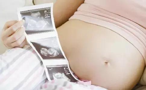 说个羞羞的事,顺产会影响日后同房吗?