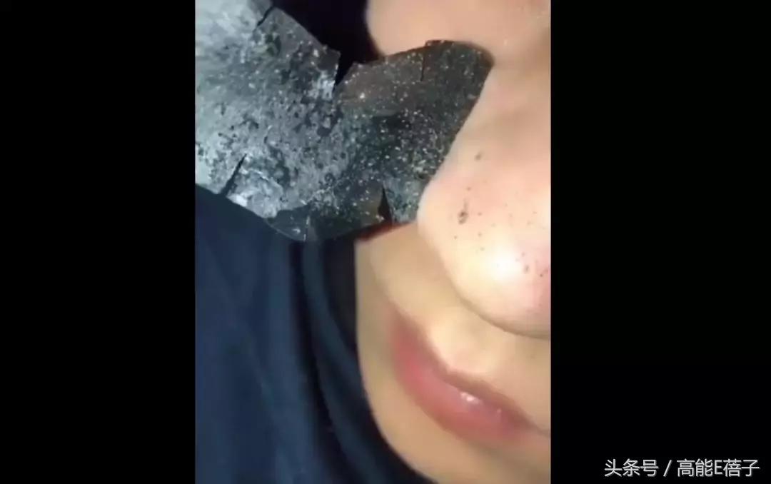 别傻了！蔡徐坤、Angelababy都根治不掉的黑头，微商神器能去除？