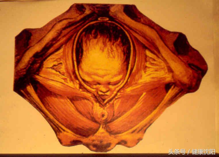 健康科普堂你的血管够坚强,健康科普堂养生