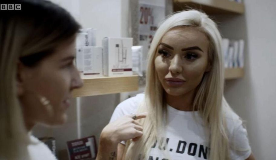 瘦脸针真有那么神奇吗,瘦脸针bbc