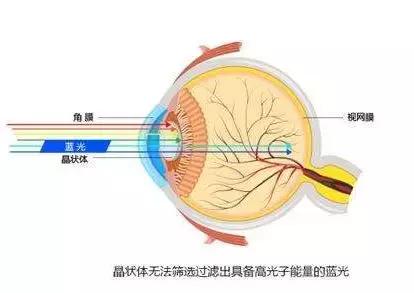 挺贵的防蓝光眼镜真的有用吗,360环焦防蓝光眼镜优缺点