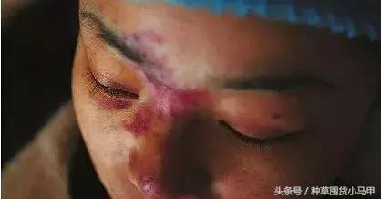 深度剖析医美整形的危害,医美整形该如何避坑呢