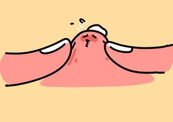 脸上长闭口怎么办教你正确祛闭口,脸上反复长闭口的原因和解决方法