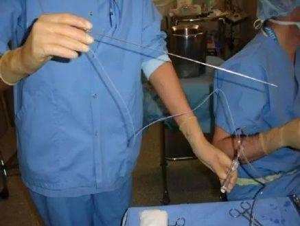 女大学生捐卵案完整,女大学生捐卵有什么危害