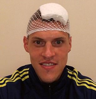 GOAL神奇:足坛第一硬汉是他?被“爆头”仍微笑后卫们学着点!