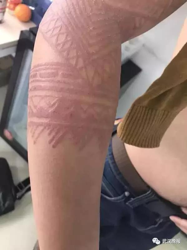 「健康」他在巴厘岛尝鲜特色服务，现在可能一辈子消不掉……悔恨啊！