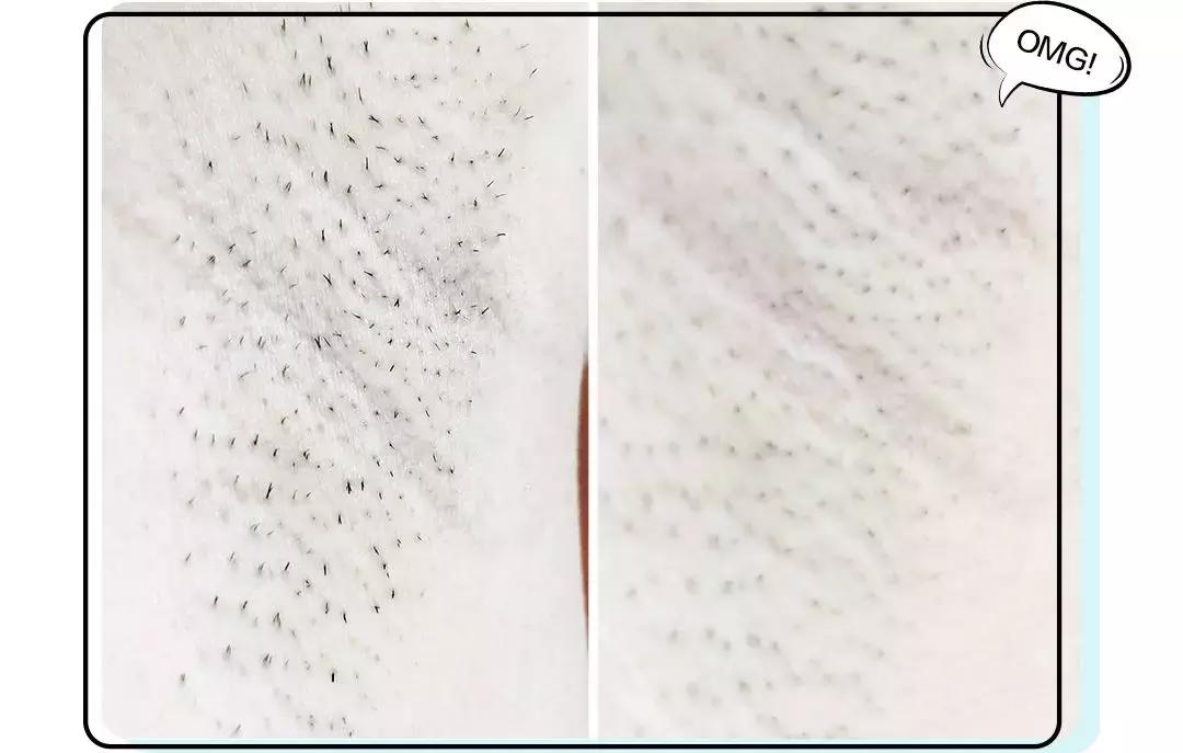 屈臣氏融汇丝滑脱毛慕斯好用吗,屈臣氏好物推荐脱毛神器