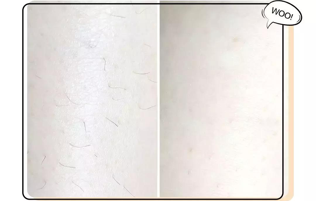 屈臣氏融汇丝滑脱毛慕斯好用吗,屈臣氏好物推荐脱毛神器