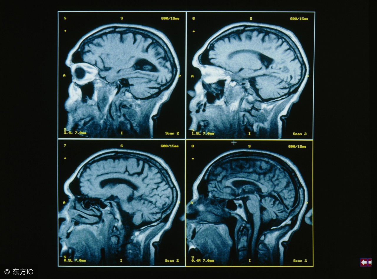 儿童脑瘤的七大征兆,儿童脑瘤的症状表现