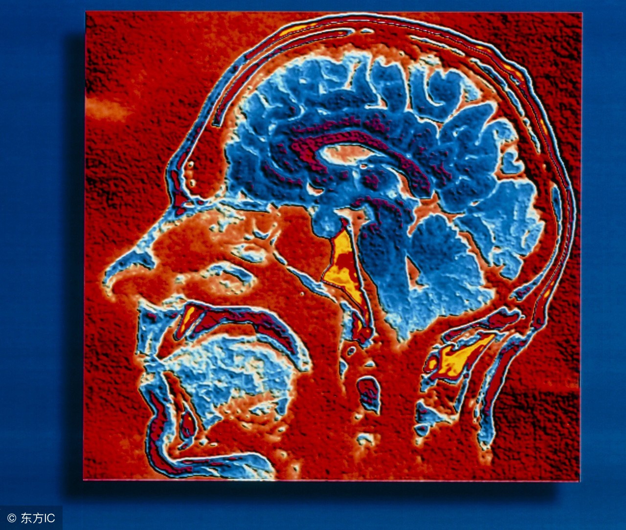 儿童脑瘤的七大征兆,儿童脑瘤的症状表现