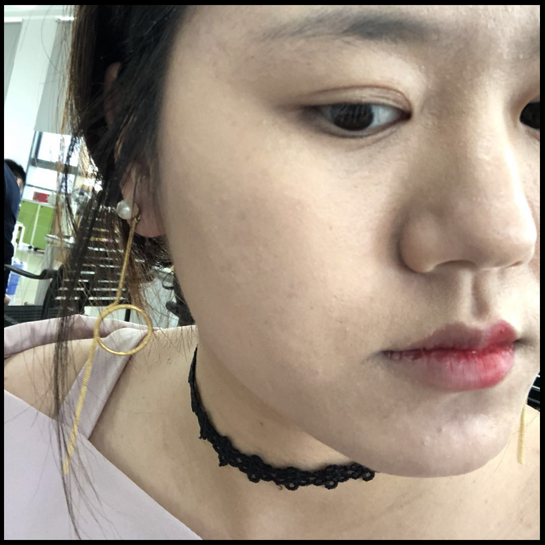 怎样消除痘印食疗,青春期痘印怎么消除小妙招