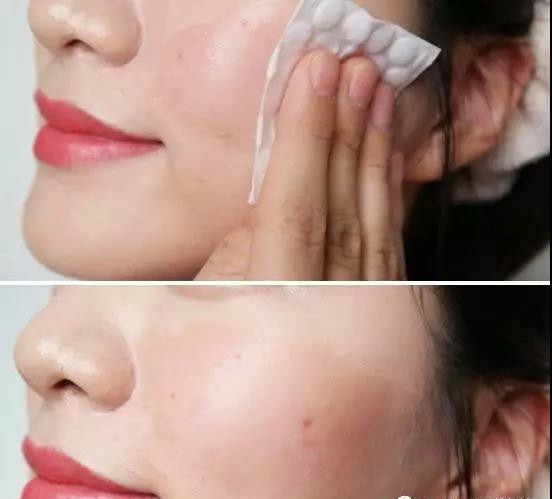 怎样卸妆最干净不伤皮肤,混合性皮肤适合用什么卸妆产品