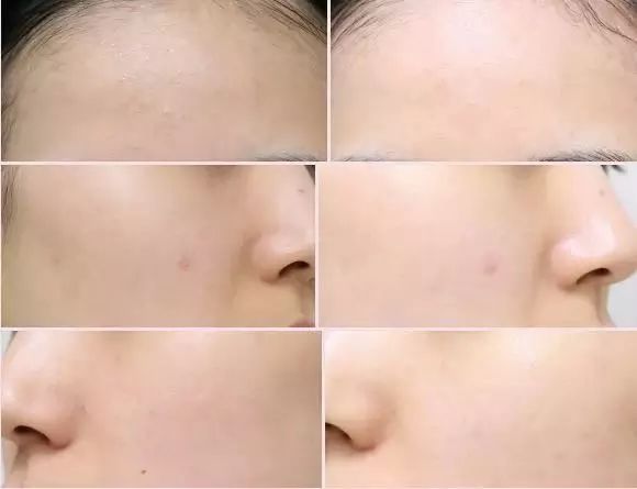 无限回购的蜂蜜面膜,韩国原辰安瓶面膜测评