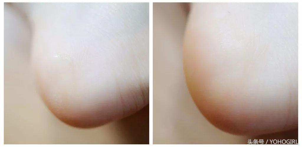 洁面脱毛仪,洁面脱毛仪测评