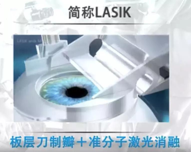 全飞秒和半飞秒治近视可重复做吗,全飞秒与半飞秒的治疗效果