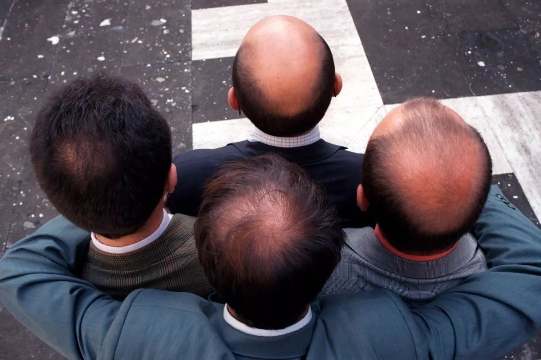 最有效的防脱育发的偏方,全网最靠谱的防脱发方法