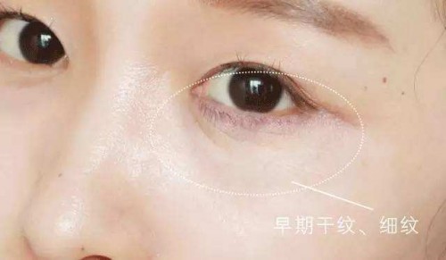 眼部视力问题,眼部问题需要做哪些医美