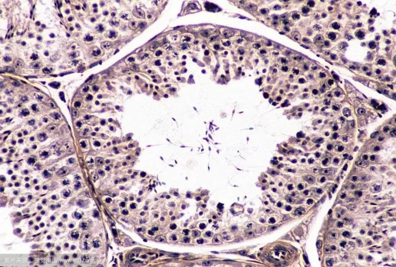 无精症遗传给女儿,无精症生的孩子会有缺陷吗