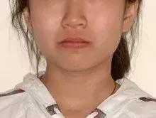 矫正牙齿可以变美吗,矫正牙齿后变美更自信