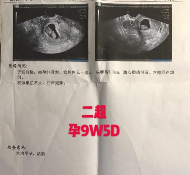 分享我两次备孕的成功经历,备孕成功的真实经验分享