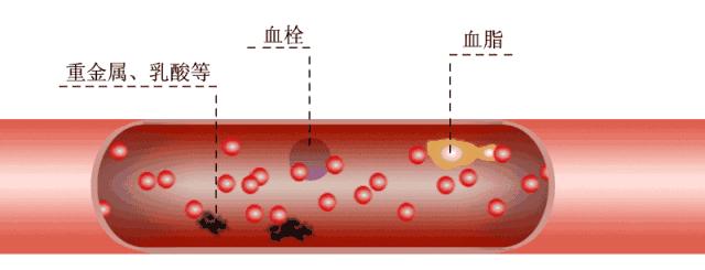 人的血管为什么这么脆弱,人的血管脆怎么办