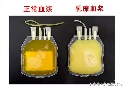 怎么清除血液中的脂肪,血液里面的脂肪要吃什么处理