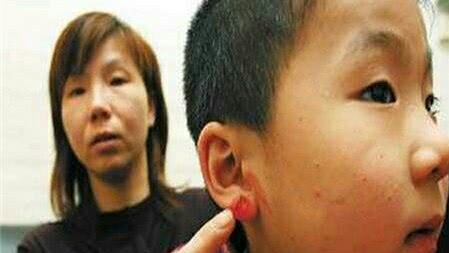 宝宝耳朵有个小洞是什么福气,孩子耳朵上有个富贵洞