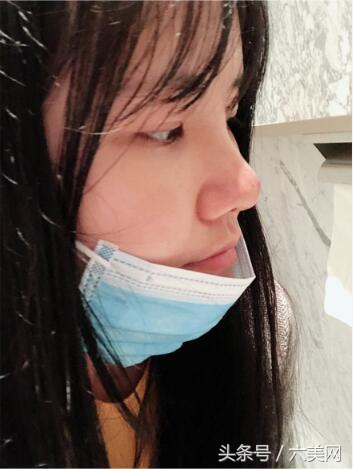 隆鼻后如何克服焦虑,隆鼻后前三天状态