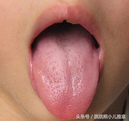 怎么看宝宝舌头是否积食,宝宝积食的舌头是怎样的