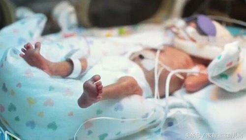警惕!早产儿会有很多并发症的可能!如何避免?