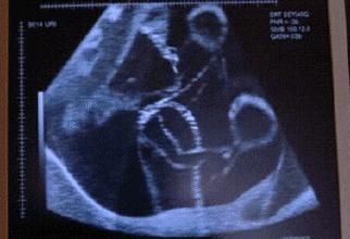 还记得第一次牵手的心跳么,感受当初胎动的感觉