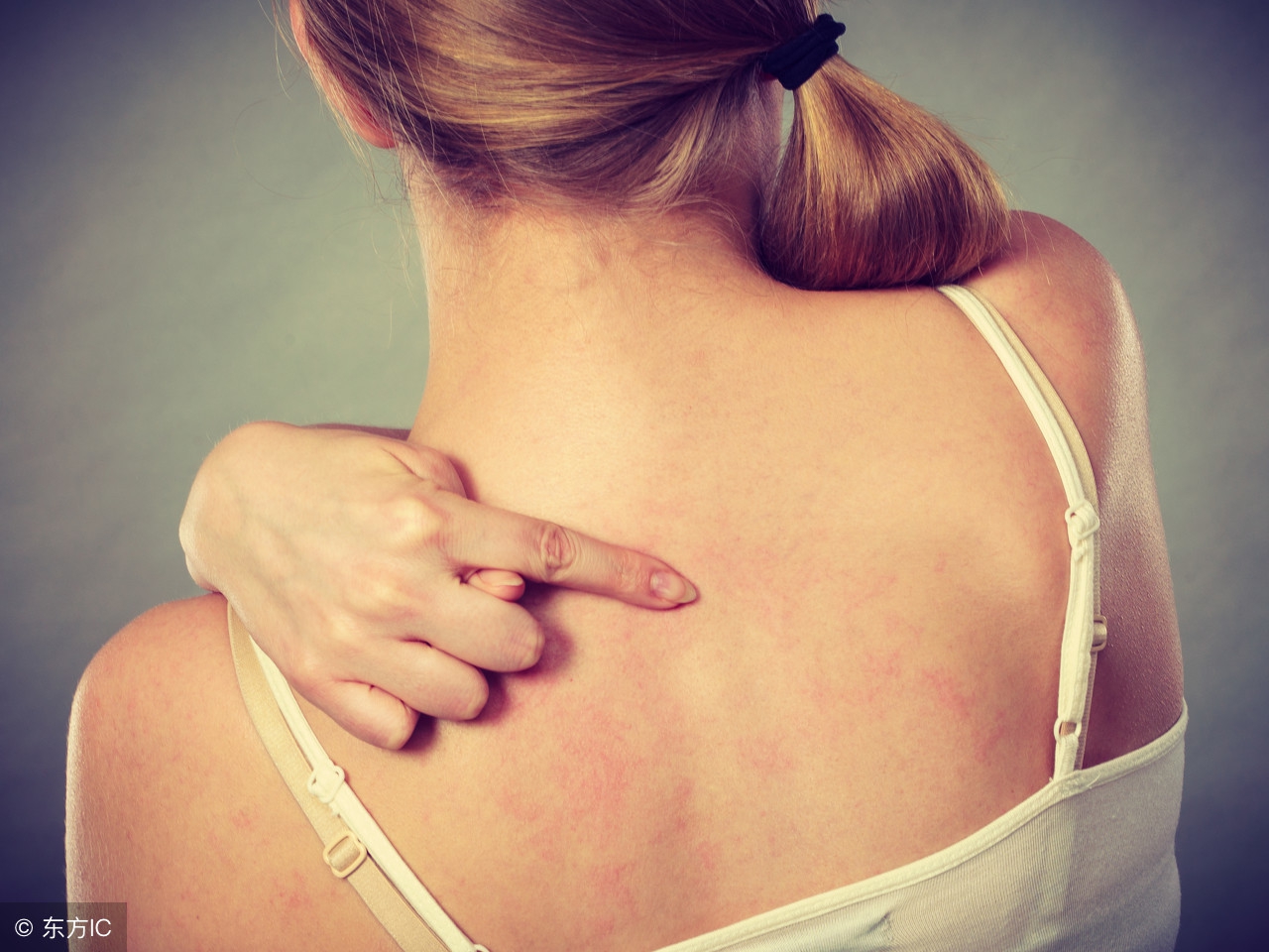 夏天一出汗身上就痒像长痱子,夏天出汗身上长了很多小红疙瘩痒