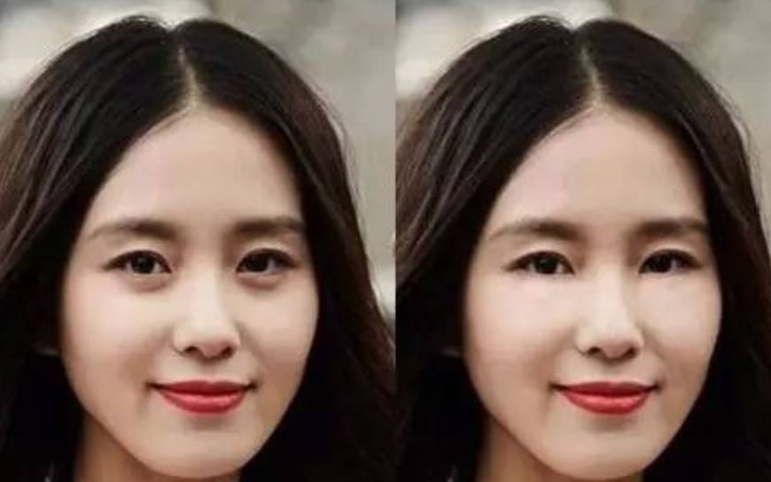 有卧蚕和没有卧蚕对比图,有卧蚕和没有卧蚕的对比