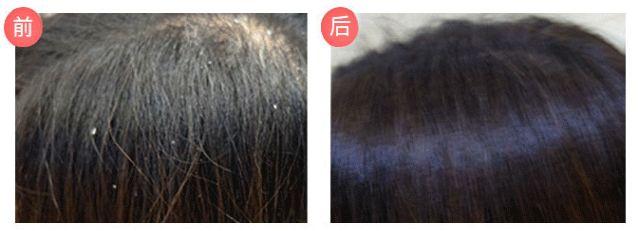 值得回购多次的护肤洗发水,护肤心得是什么