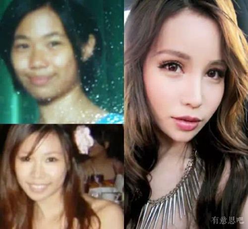 你对整形这件事情怎么看,你对整容的看法英语