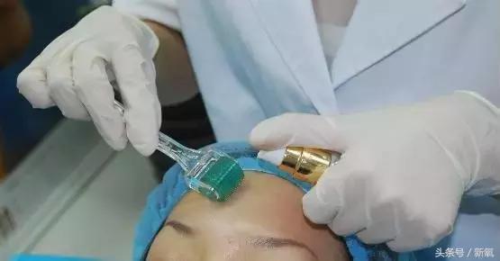 微针祛皱纹效果怎么样,家用抗皱美白祛斑微针