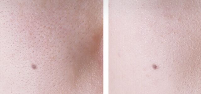 日本乐敦cc能美白吗,乐敦cc维c美白淡斑霜好用吗