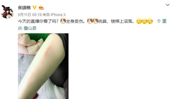 从性感女神到乡下小妹,张琪格开启户外直播变形记,网友:不容易