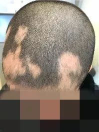 理发师看到长发男孩,理发师看到一个男孩头上长满旋