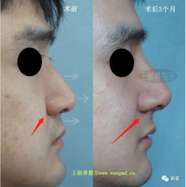 迪丽热巴被p图事件回应,迪丽热巴被p图的视频