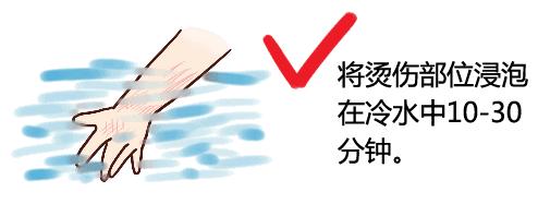 儿童玩耍金属滑梯被烫伤怎么处理,孩子玩滑滑梯屁股被烫伤