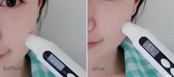 洁面吸油神器,电动洗脸神器清洁毛孔