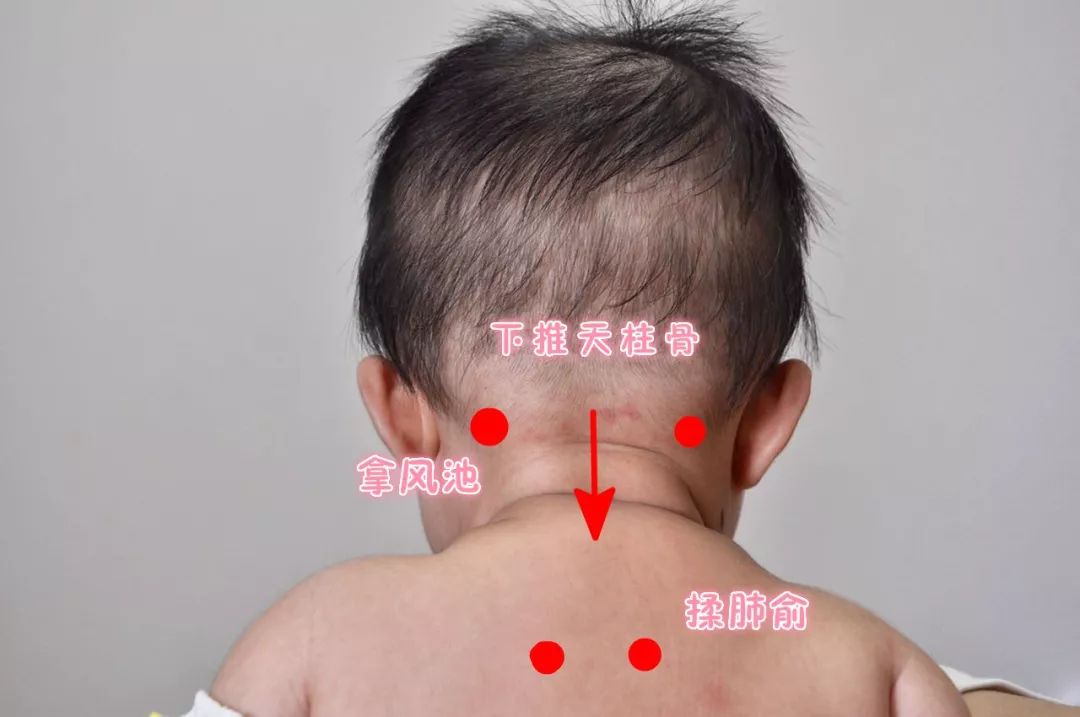 小儿推拿贴敷配方大全,小儿推拿如何学会配穴