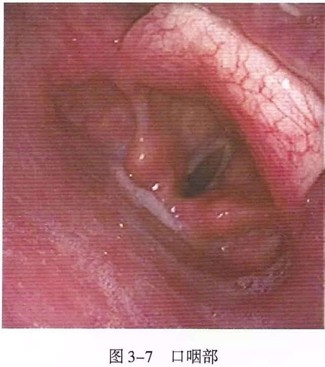 上呼吸道解剖视频教程,呼吸道生理与解剖课件