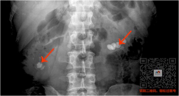 执医技能：X线阅片，全是套路，超简单